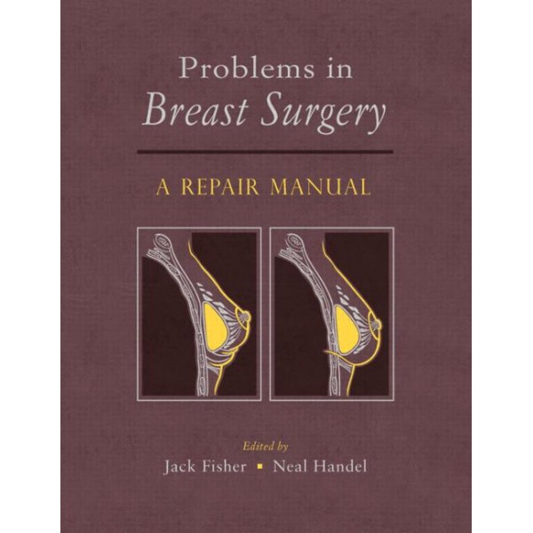 Problems in Breast Surgery